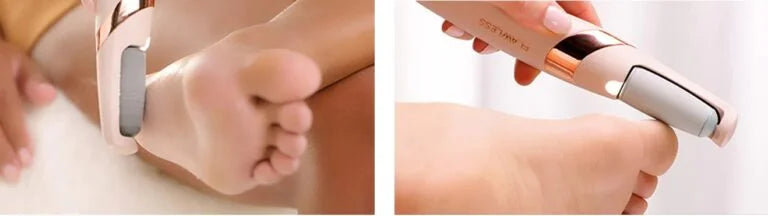 Profesionalna turpija za pete