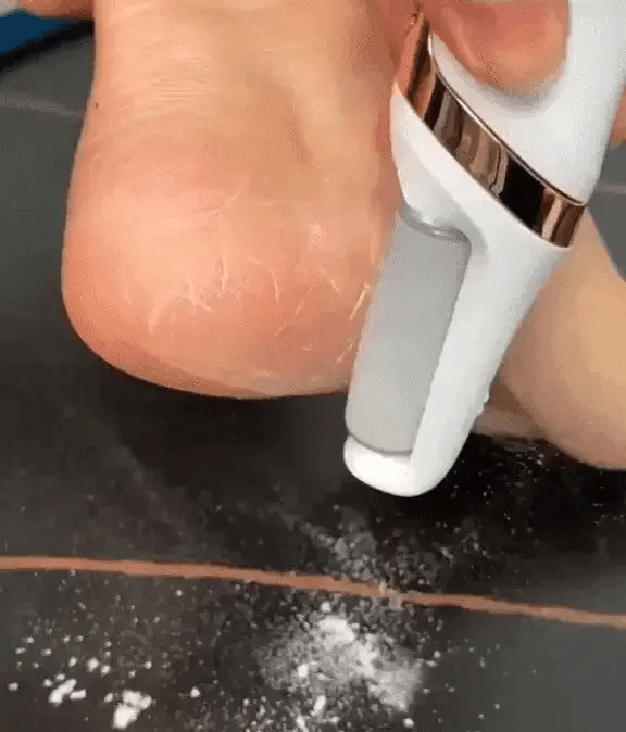 Profesionalna turpija za pete